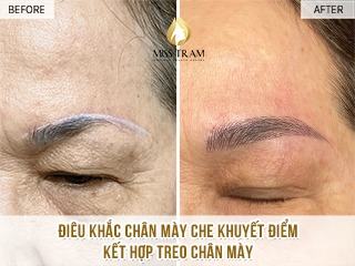 Điêu Khắc Chân Mày Che Khuyết Điểm Treo Chân Mày Cho Cô Phượng Thông tin