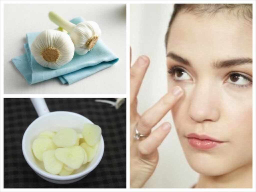 How To Treat Acne With Fresh Garlic The Right Way Document