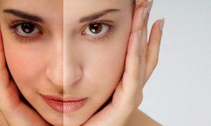 10 Causes Of Dark Skin Quickly Research
