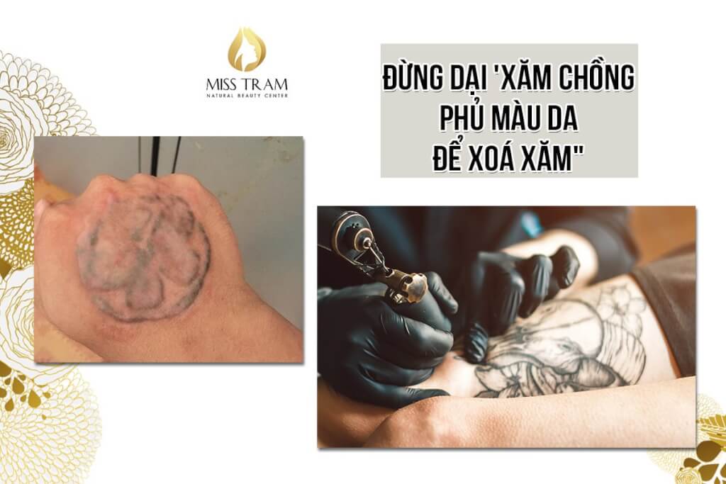 Đừng Dại Xăm Chồng Phủ Màu Da Để Xoá Xăm