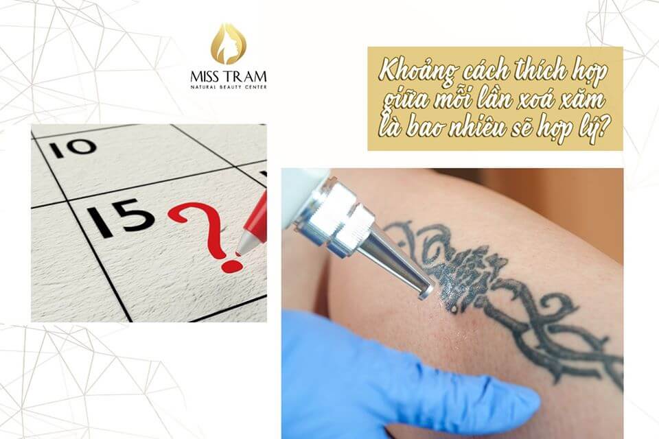 How Much Appropriate Distance Between Each Tattoo Removal Will Be Reasonable To Discover