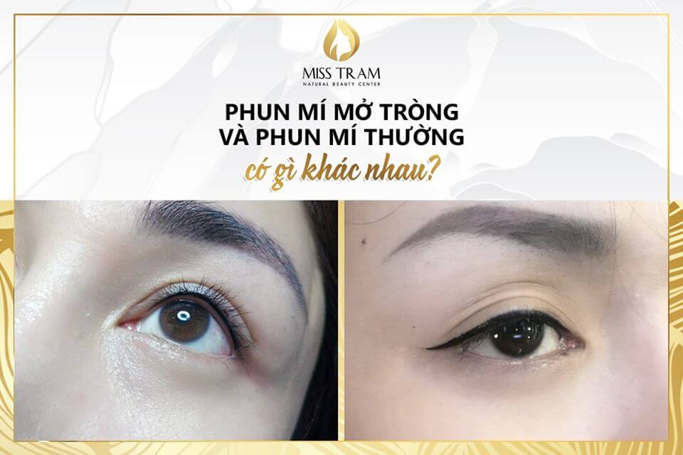 Phun Mí Mở Tròng và Phun Mí Thường Có Gì Khác Nhau Thật bất ngờ