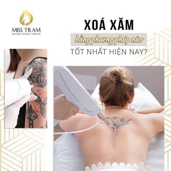 Phương Pháp Xóa Xăm Nào Tốt Nhất Hiện Nay