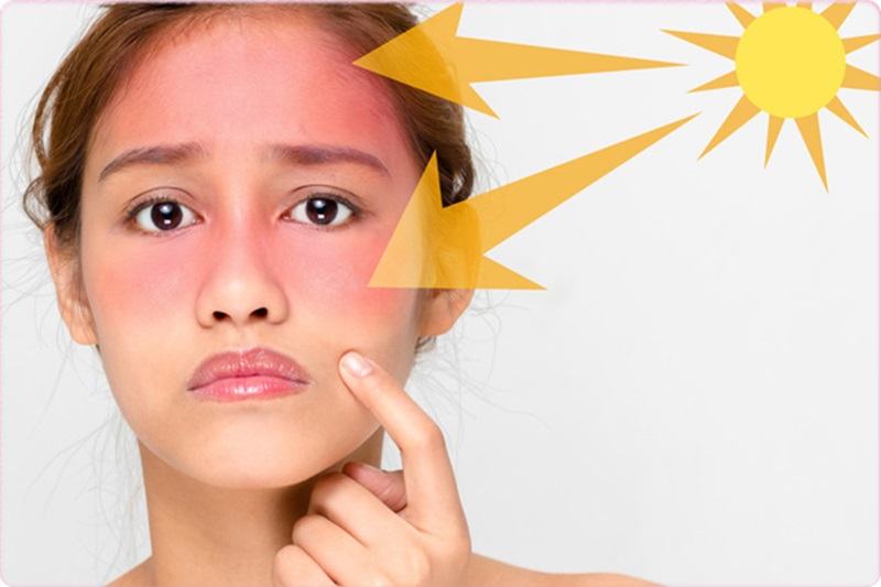 Scar Treatment Service - Long-term Pimples Miss Tram Tips