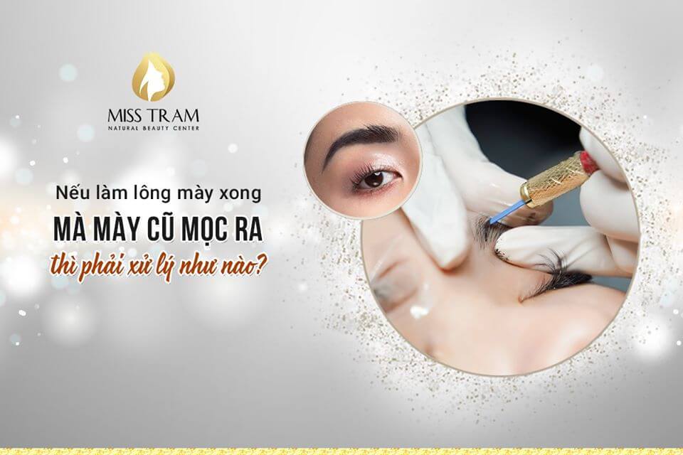 Làm Lông Mày Xong Mà Mày Cũ Mọc Ra Thì Phải Xử Lý Thế Nào Kiểm duyệt