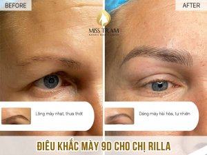 Kết Quả Điêu Khắc Mày 9D Cho Chị Rilla Mở mắt