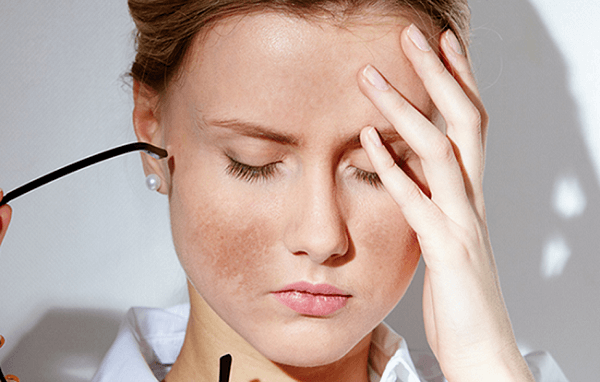 TECHNOLOGY TO REMOVE Melasma - Freckles ORIGINAL SAFETY
