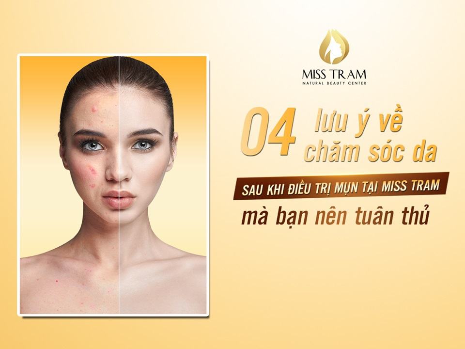 4 Skin Care Notes After Acne Treatment At Miss Tram You Should Follow Popular