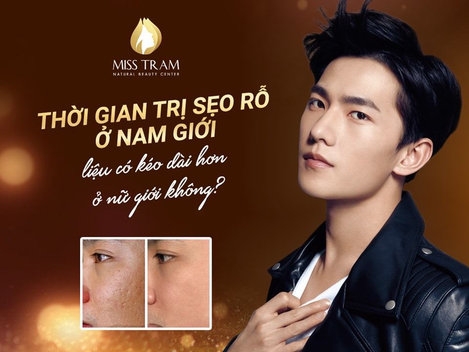 Thời Gian Trị Sẹo Rỗ Ở Nam Có Kéo Dài Hơn Nữ Không Đằng sau