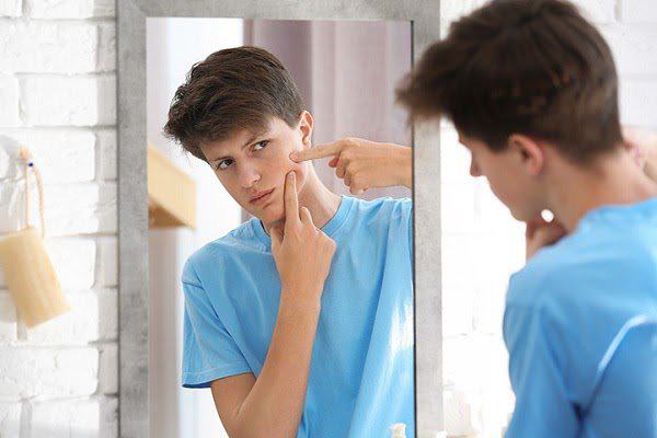 How To Treat Acne And Acne For Men As You Like