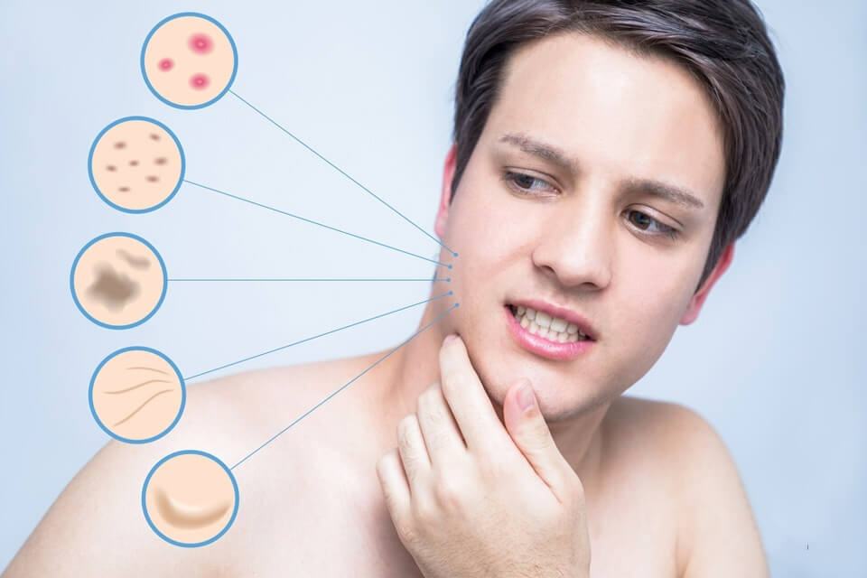 Nam giới có nên đi spa chăm sóc da?