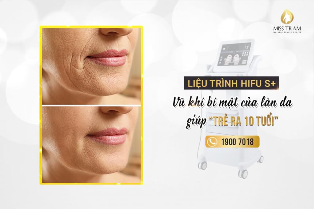 Top 2 Liệu Trình Trẻ Hóa Da Kéo Dài Tuổi Thanh Xuân Ghi chú