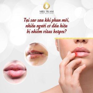 Learn About Herpes Virus Infection When Spraying Lips Value