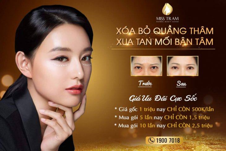 Xóa Bỏ Quầng Thâm – Xua Tan Mối Bận Tâm Cùng Miss Tram Spa