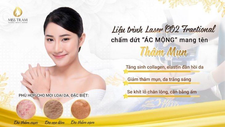 Trị Thâm Mụn Với Liệu Trình Laser CO2 Fractional và Serum Dori