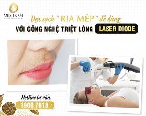 Phương Pháp Triệt Ria Mép Với Công Nghệ Triệt Lông Laser DioDe Giá trị