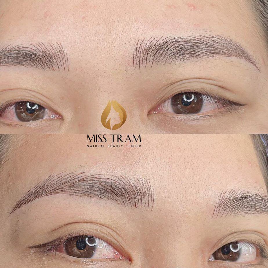 Choose Which Eyebrow Aesthetic Method Is Right For You