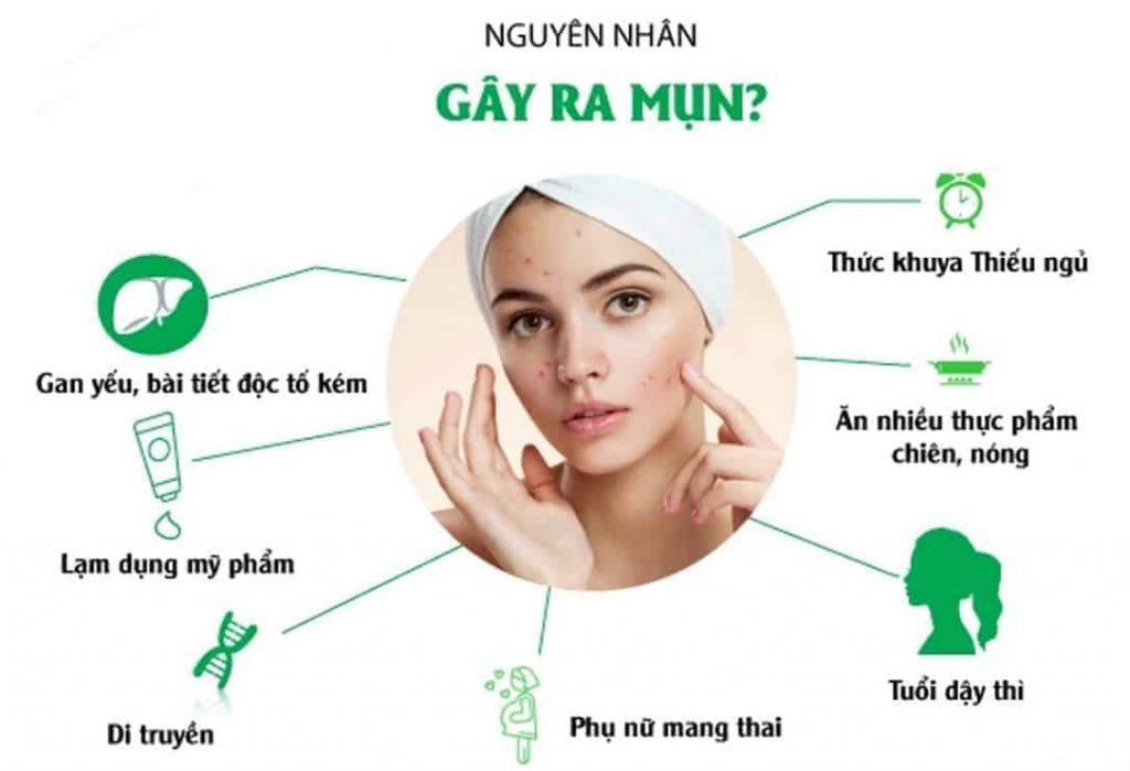 Nguyên nhân gây nên mụn