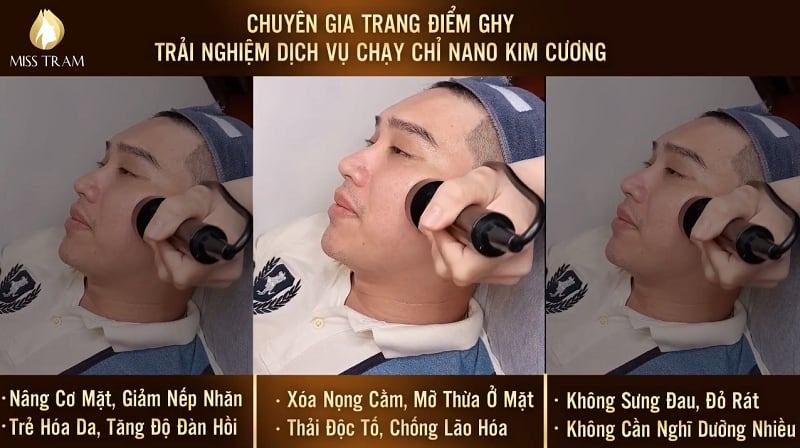 CGTĐ Ghy đánh bay nọng cằm với dịch vụ chỉ Nano Kim Cương