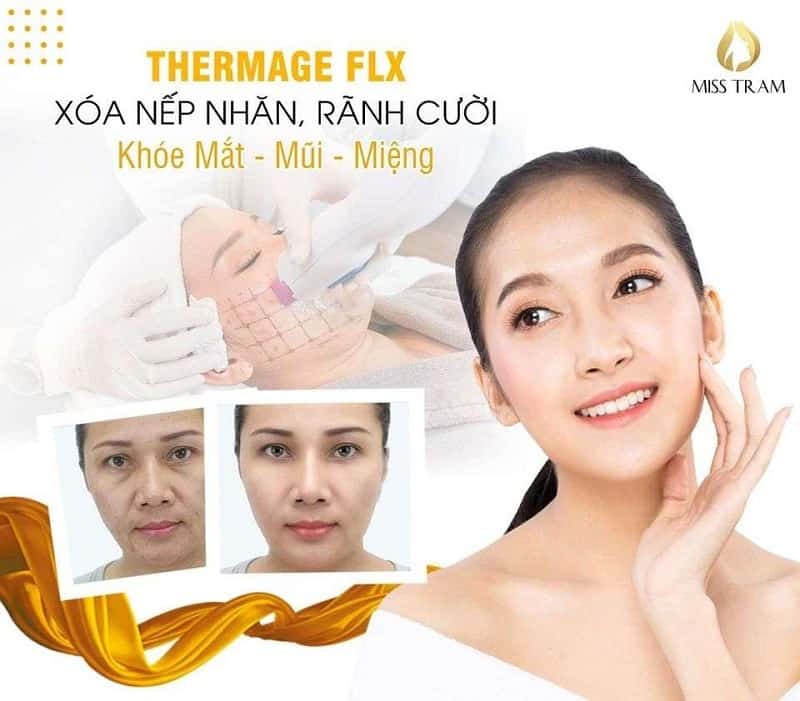 Thermage FLX technology