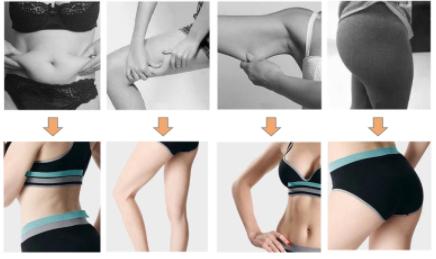 Liệu trình XbodyFit – Giảm béo mỡ, săn gọn ngoại hình ngay mà không cần chờ giảm cân Xác thực