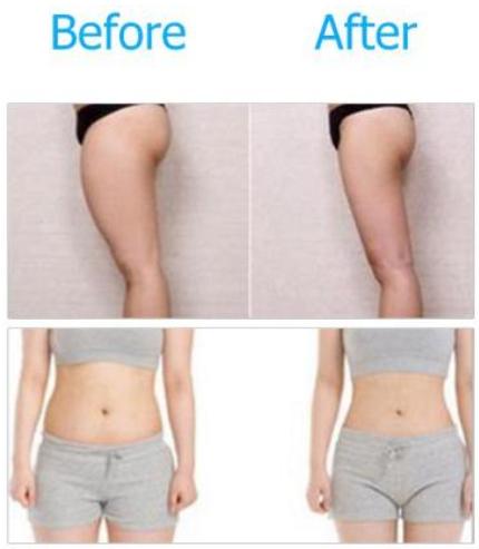 XbodyFit process – Lose fat, tone your appearance right away without waiting for weight loss Authentic