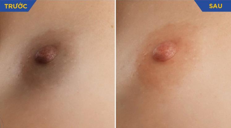 Address Do Hong - Safe, Prestigious and Prestigious Breast Removal in Ho Chi Minh City Prove