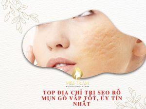 TOP Địa Chỉ Trị Sẹo Rỗ Mụn Gò Vấp Tốt, Uy Tín Nhất