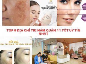 Top Địa Chỉ Trị Nám Quận 11 Tốt Uy Tín Nhất