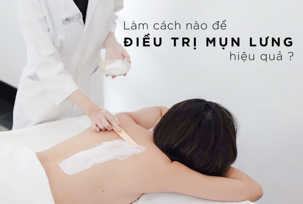 dịch vụ trị mụn lưng an toàn quận 8 hcm