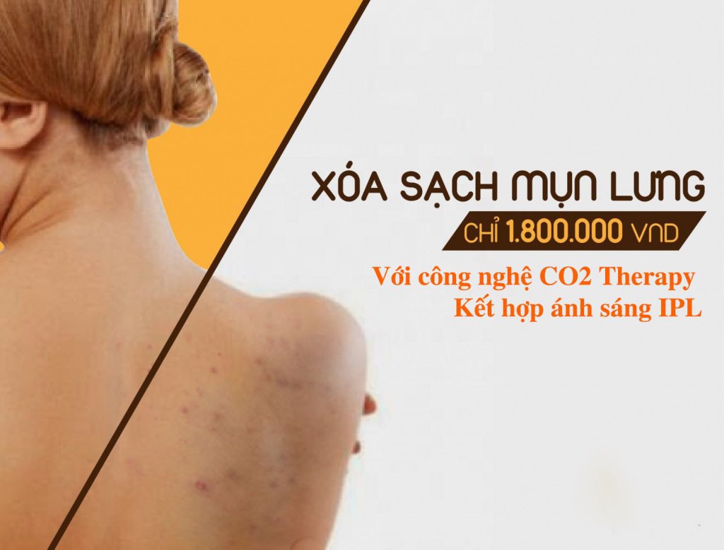 địa chỉ trị mụn lưng uy tín tại quận 8