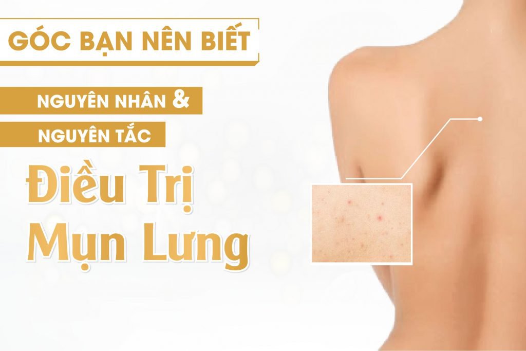 spa trị mụn lưng uy tín nhất quận 9