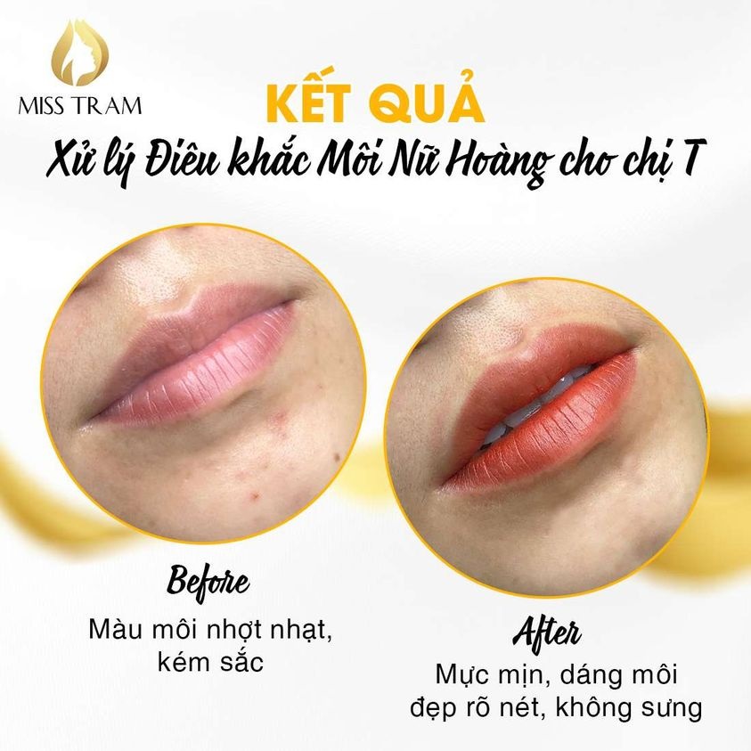 Kết quả xử lý điêu khắc môi Nữ Hoàng mực mịn, dáng môi rõ nét