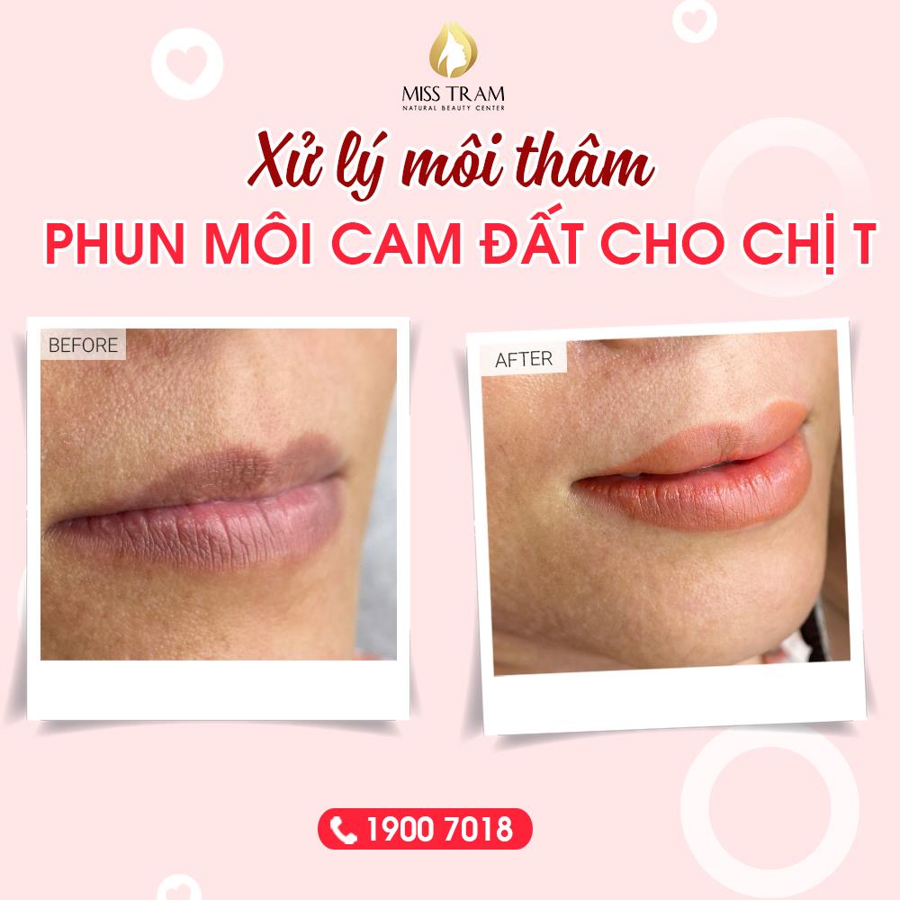 Kết quả xử lý môi thâm và phun môi màu cam đất đẹp