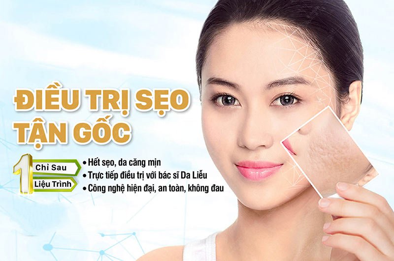 Safe place to treat acne scars, District 10, Ho Chi Minh City