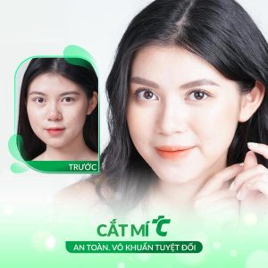 Review of Beauty Services of Thu Cuc Clinic HCM: Service, Quality, Quotation? Study