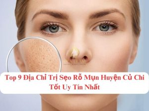 Top 9 Địa Chỉ Trị Sẹo Rỗ Mụn Huyện Củ Chi Tốt Uy Tín Nhất Trực tiếp