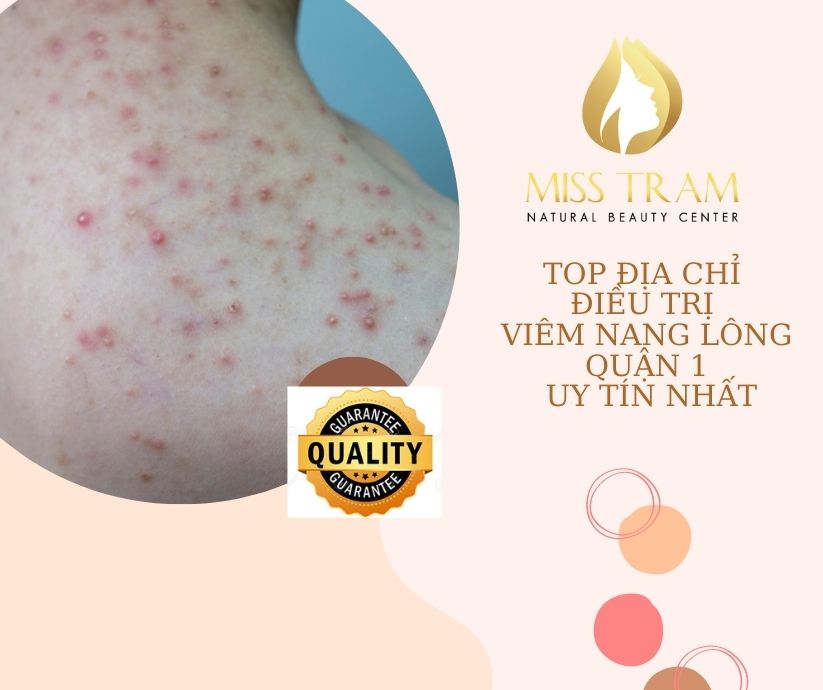 Spa trị viêm nang lông Quận 1