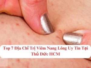 địa chỉ trị viêm nang lông an toàn quận thủ đức