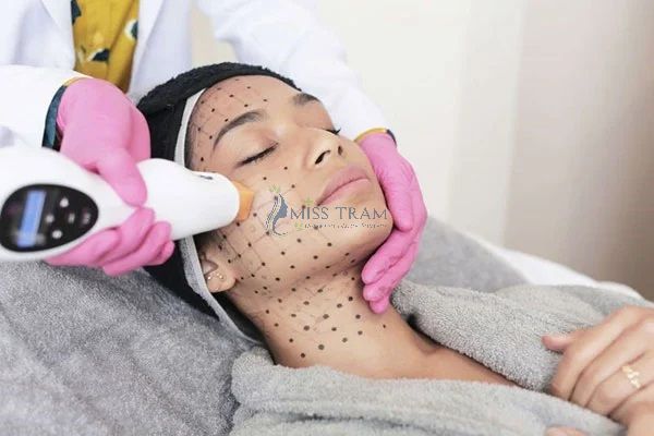 giá dịch vụ trẻ hóa da Thermage FLX