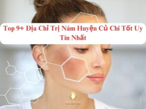 spa trị nám tận gốc an toàn tại củ chi hcm