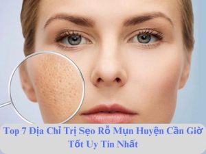 giá dịch vụ trị seo rỗ uy tín huyện cần giờ