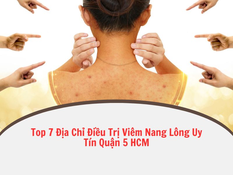 liệu trình trị viêm nang lông an toàn quận 5