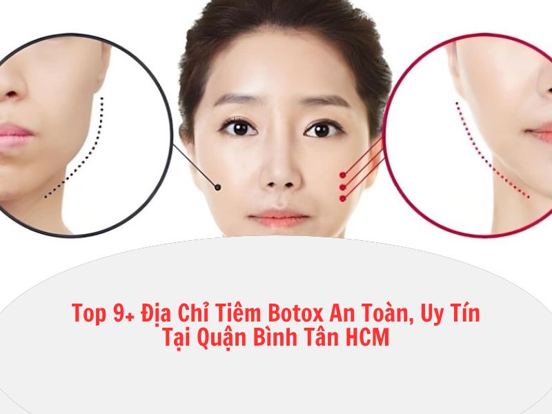 spa tiêm botox an toàn quận bình tân