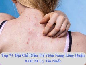 spa điều trị viêm nang lông an toàn quận 8