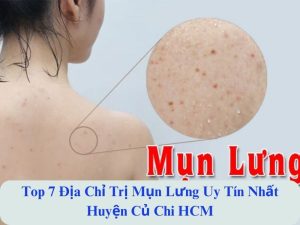 địa chỉ trị mụn lưng an toàn huyện củ chi