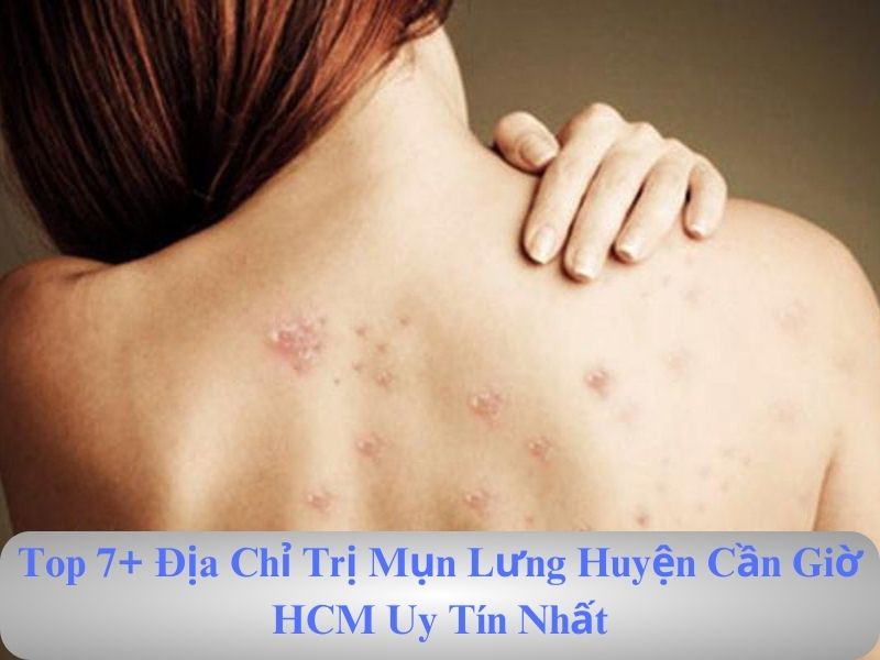 nổi mụn ở lưng là dấu hiệu bệnh gì