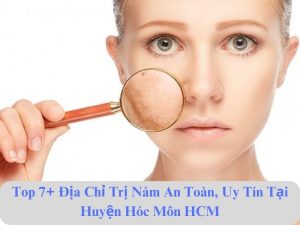 liệu trình trị nám an toàn