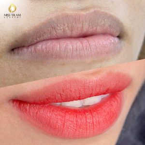 Môi Thâm Trở Nên Hồng Tự Nhiên | Trước Thâm Xỉn – Sau Rạng Rỡ Lộ diện