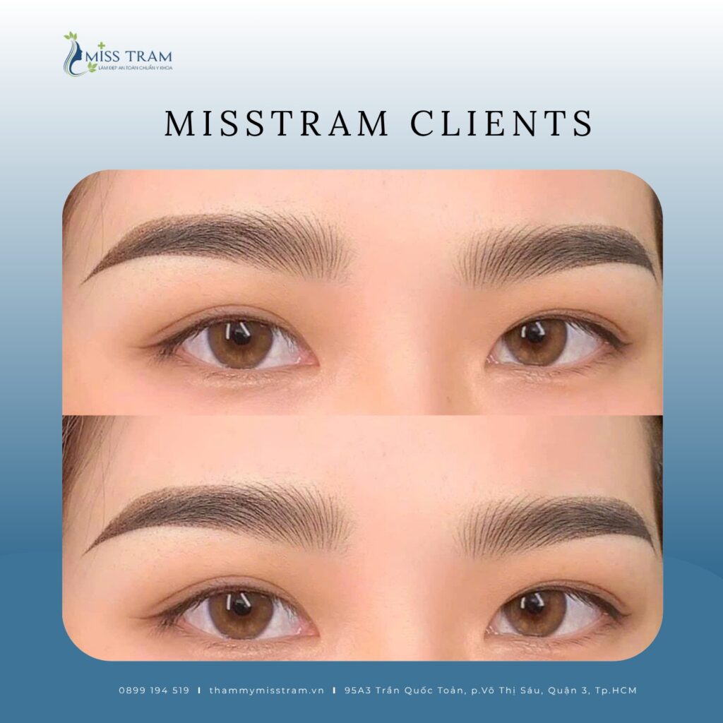 Điêu Khắc Chân Mày: Giải Pháp Nhanh Chóng Cho Đôi Mày Hoàn Hảo Đầy đủ